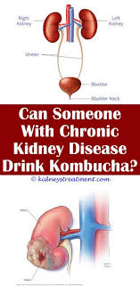 3 Ultimate Hacks Kidney Stones Baking Soda Kidney Diet Diet Website Kidney Disea Kidney Disease Awareness Treatment For Kidney Disease Kidney Disease Recipes