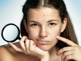 Kekurangan vitamin b2, c, e , betakarotin dan potasium juga adalah punca kepada kulit kusam dan berjerawat. 5 Punca Kulit Wajah Mulai Kusam Bermasalah No 2 Paling Ramai Yang Buat Mingguan Wanita