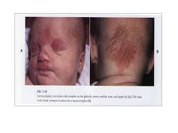 Het 'zevende dag' onderzoek