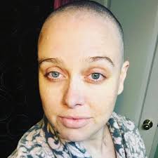 Please pray for my Niece Jessica Lee Knapp who is having A serious Surgery 