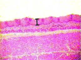 Non keratinized stratified squamous epithelium. Stratified Squamous Non Keratinized Epithelium
