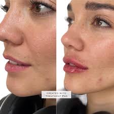 Dr. Pablo Abarca • Medicina Estética