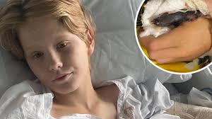 Qld teen loses thumb in horror rodeo accident