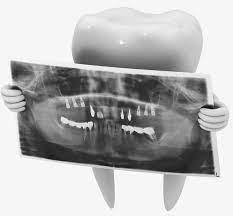 Dental X Ray Film X Ray Clipart Oral Examination Tooth Png Transparent Clipart Image And Psd File For Free Download Dental Fun Dental Ray Film