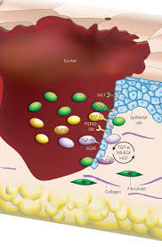 Image result for Wound Repair