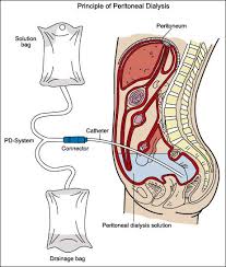Pelukan Mengeratkan Kasih Sayang With Images Peritoneal Dialysis Dialysis Nurse Dialysis