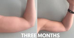 How I Got Rid Of Arm Flab In Time For Summer