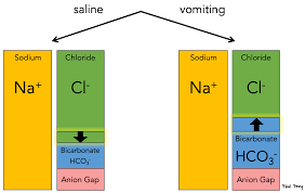 Image result for Hyperchloremia