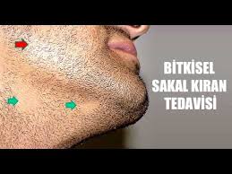 Sakal Kiran Tedavisi Nasil Yapilir Youtube