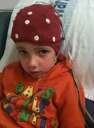 Looking for someone to do the eeg