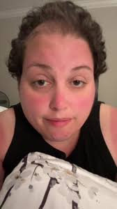 Savanna Johnson Cancer