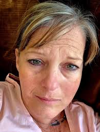 Does anyone have Epilepsy & RA ( Rheumatoid Arthritis)? I'm seeing a  Rheumatologist in January and I was wondering what symptoms you first  noticed?