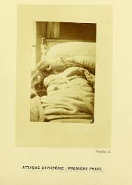 On the whole, it obscured his other work in the medical and especially public mind, but remarkably it is now his work on hysteria that has endured least and is indeed almost completely discredited. Iconographie Photographique De La Salpetriere Service De M Charcot 26 Flashbak