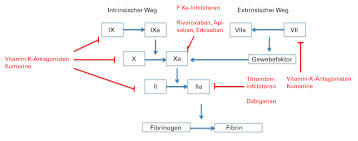 Bericht 2 als pdf xdream travel from img.yumpu.com. Antikoagulantien Pass Pdf Zahnarztliche Chirurgie Unter Oraler Antikoagulation Thrombozytenaggregationshemmung Zm Online Antikoagulans Bezeichnet Ein Wirkmittel Durch Das Blut Weniger Schnell Gerinnt Inorganikask