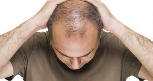 Microneedling can be performed by a professional, but you can use a dermaroller or . Microneedling For Hair Loss Another Level Medispa