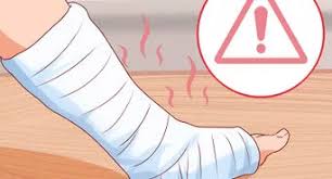 De esta manera podrás ver claramente todas las áreas de su cuerpo. 3 Formas De Quitar Espinas De Cactus Wikihow