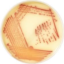 This type of bacteria is resistant to many different antibiotics. Chromid Mrsa Smart Biomerieux Deutschland