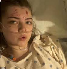 Texas teen is severely injured after being struck by car while walking to  frat house party
