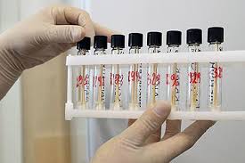 Российская вакцина от коронавируса «спутник v» получила регистрационное удостоверение от минздава беларуси 21 декабря. Multicentrovye Issledovaniya Rossijskoj Vakciny Ot Covid 19 Projdut V Lechebnyh Uchrezhdeniyah Belarusi Glavnye Novosti Belarusi Sobytiya Resheniya Vyskazyvaniya Belarus By