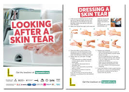 Image result for Skin Tear