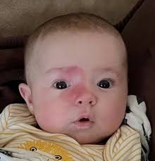 Hunter Kane Newman, 4 months