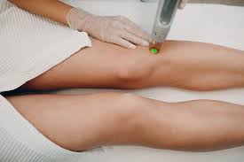 But the treatment is now effective on all skin types. When Should You Start Laser Hair Removal