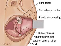 Buccal Cancer Anatomy