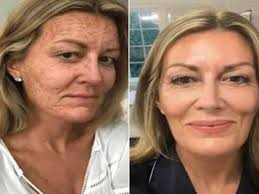 Best nurse practitioner/physician's assistant: Sarah Neumann