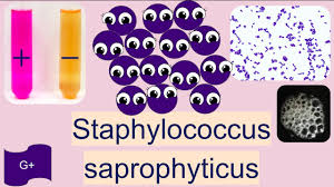 Image result for Staphylococcus Saprophyticus