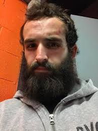 I lost my fight last night by 2nd round TKO. Got dropped 4 times but kept  getting up to continue fighting. Ref stopped the fight before my body even  hit the floor