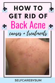 Pin On Beauty Community