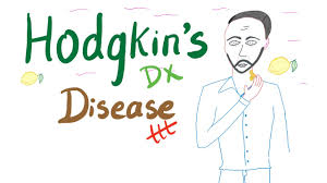 Lymphoma of stomach (5516) non hodgkin lymphoma 1 hodgkin's name comes from the physician thomas hodgkin, who in the nineteenth. Hodgkin S Disease Lymphoma Diagnosis Treatment Youtube