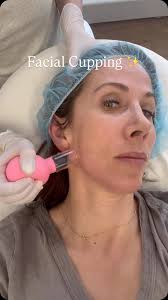 Unlock the secret to radiant skin with facial cupping! ✨ This ancient  technique promotes lymphatic drainage, reducing puffiness and detoxifying  your skin. Ready to elevate your skincare routine? 💆‍♀️ ...