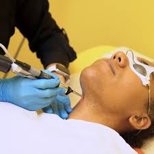 Laser Hair Removal Everything You Need To Know Racked