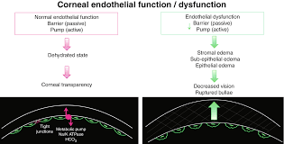 Annoncé en septembre 2020 puis daté au début du mois de mars, monster hunter stories 2 : Fuchs Endothelial Corneal Dystrophy Rethinking An Old Disease With Insights From The Laboratory And Clinical Practice Springerlink