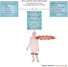 Strategies For The Prevention Of Knee Osteoarthritis | Nature Reviews  Rheumatology