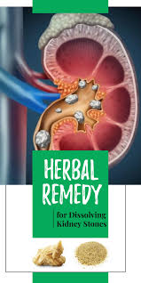Herbal Remedy For Dissolving Kidney Stones Kidney Stones Herbalism Herbal Remedies