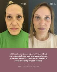 Dra. Franciele de Freitas