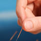 Community Acupuncture event image
