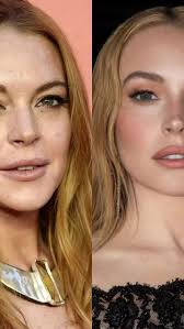 What else do you think she has had done? She looks amazing!