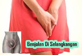 Pin Di Jelly Gamat Qnc