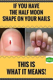 Look At Your Fingernails Did You Notice A White Half Moon Shape That Starts At Your Nail Beds In Fact It Is A Very Impor You Nailed It Health Natural Health