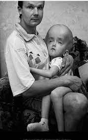 Find the perfect chernobyl victims stock photo. 18 Chernobyl Disaster Ideas Chernobyl Disaster Chernobyl Disasters
