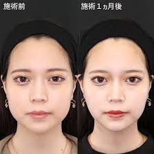 丸 顔 顔 痩せ