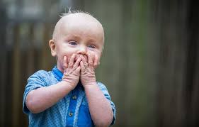 Toddler's skin looks like fish scales