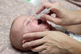 Cara mengatasi hidung tersumbat bayi dengan alat dan obat. Yuk Bunda Kenali Cara Mengatasi Hidung Tersumbat Pada Bayi Alodokter