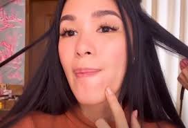 You can make it happen — heart evangelista. Heart Evangelista Successfully Undergoes Surgery For Cyst Mistaken As Pimple Philstar Com