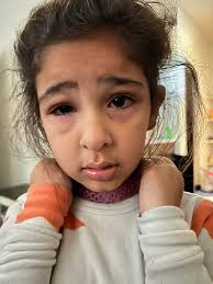 New build home allergies: advice needed