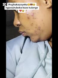 Observing My Rich Cousin's Barefoot Fridge Walk