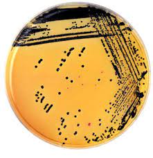 Quality control all lot numbers of salmonella shigella. Hyserve